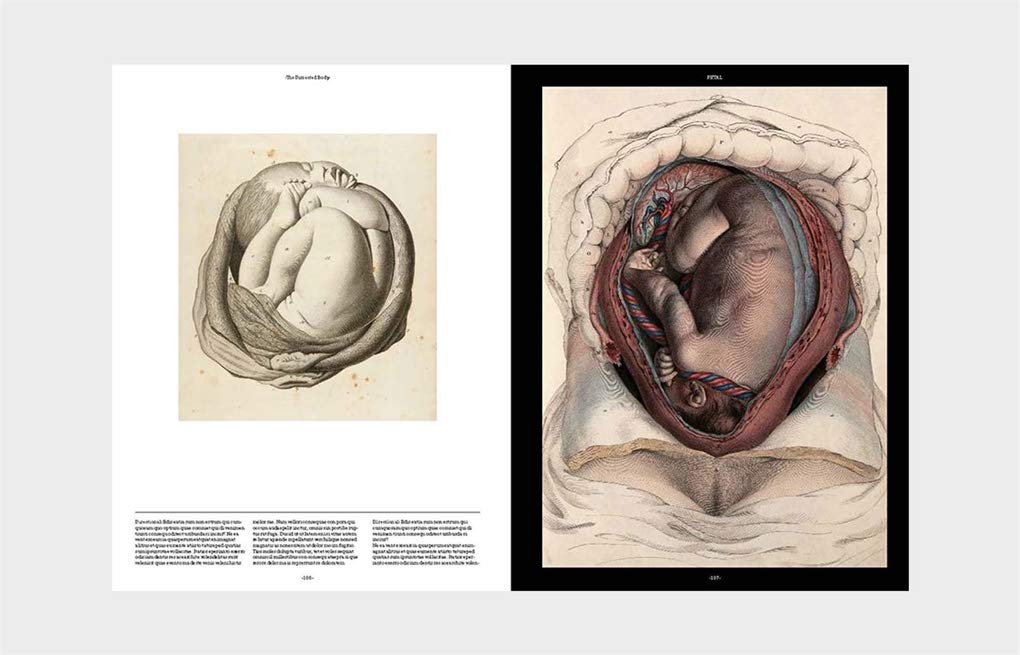 Philimonius boek Laurence King Anatomica