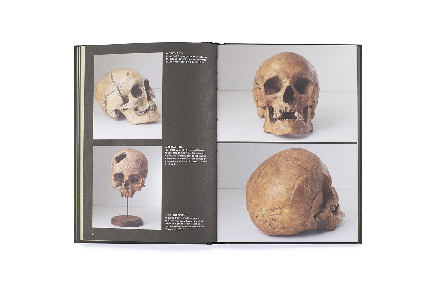 Skulls